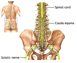 cauda equina